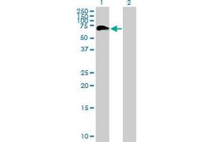 Western Blot analysis of PHF23 expression in transfected 293T cell line by PHF23 MaxPab polyclonal antibody. (PHF23 抗体  (AA 1-403))