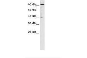 Image no. 1 for anti-OTU Domain Containing 7B (OTUD7B) (AA 559-608) antibody (ABIN202938) (OTUD7B 抗体  (AA 559-608))
