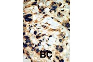 Immunohistochemistry (Paraffin-embedded Sections) (IHC (p)) image for anti-serum/glucocorticoid Regulated Kinase 2 (SGK2) (AA 395-426), (C-Term) antibody (ABIN392461)