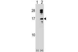 Western blot analysis of CLC (arrow) using rabbit polyclonal CLC Antibody (C-term) . (Galectin 10 抗体  (C-Term))