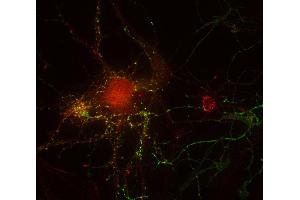 Indirect immunostaining of PFA fixed rat hippocampus neurons with anti-ZnF 365 (dilution 1 : 500; red) and mouse anti-synapsin 1 (cat.