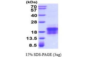 Vascular Endothelial Growth Factor C (VEGFC) (AA 112-227) protein (His tag)