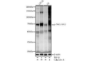 Western blot analysis of extracts of various cell lines, using Phospho-T-S412 antibody (ABIN3019511, ABIN3019512, ABIN3019513 and ABIN6225441) at 1:1000 dilution. (MAP3K7 抗体  (pSer412))