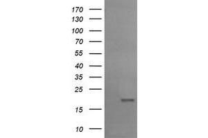 Image no. 1 for anti-Ubiquitin-Conjugating Enzyme E2G 2 (UBE2G2) antibody (ABIN1501635) (UBE2G2 抗体)