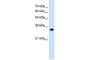WB Suggested Anti-HMGCL Antibody Titration:  0. (HMGCL 抗体  (C-Term))