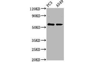 Western Blot Positive WB detected in: PC-3 whole cell lysate, A549 whole cell lysate All lanes: CYP1B1 antibody at 6. (CYP1B1 抗体  (AA 282-409))