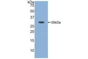 Detection of Recombinant PLS3, Mouse using Polyclonal Antibody to Plastin 3 (PLS3) (Plastin 3 抗体  (AA 5-251))