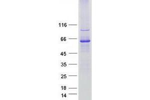 Western Blotting (WB) image for Ganglioside-Induced Differentiation-Associated-Protein 2 (GDAP2) (Transcript Variant 1) protein (Myc-DYKDDDDK Tag) (ABIN2721776)
