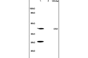 Lane 1: mouse brain lysates Lane 2: mouse kidney lysates probed with Anti HSD17B2 Polyclonal Antibody, Unconjugated (ABIN750193) at 1:200 in 4 °C. (HSD17B2 抗体  (AA 151-250))