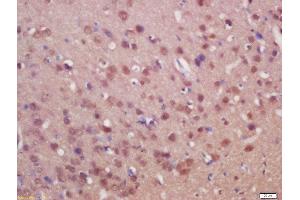 Formalin-fixed and paraffin embedded rat brain labeled with Anti-SUFU/Suppressor of Fused Polyclonal Antibody, Unconjugated  at 1:200 followed by conjugation to the secondary antibody and DAB staining (SUFUH 抗体  (AA 433-484))