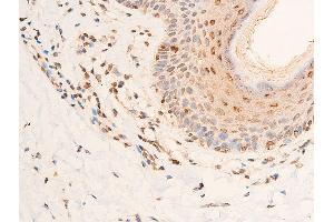 ABIN6267251 at 1/100 staining human skin tissue sections by IHC-P.
