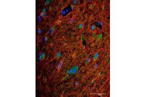 Immunofluorescence analysis of BMPR2 polyclonal antibody  in frozen section of human brain tissue. (BMPR2 抗体  (AA 28-59))