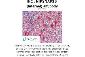 Image no. 1 for anti-Nipsnap Homolog 3B (NIPSNAP3B) (Internal Region) antibody (ABIN1737369) (NIPSNAP3B 抗体  (Internal Region))