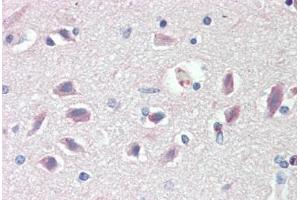 Human Brain, Cortex: Formalin-Fixed, Paraffin-Embedded (FFPE)