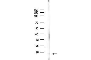 anti-Ribosomal Protein S16 (RPS16) (Internal Region) antibody