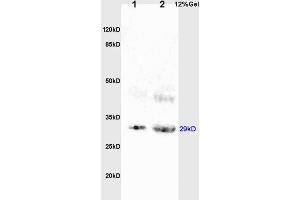 L1 rat brain lysates L2 rat kidney lysates probed with Anti BAMBI Polyclonal Antibody, Unconjugated (ABIN1714490) at 1:200 overnight at 4 °C. (BAMBI 抗体  (AA 101-200))