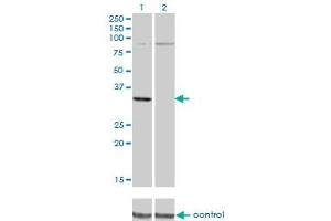 Western blot analysis of PRPS2 over-expressed 293 cell line, cotransfected with PRPS2 Validated Chimera RNAi (Lane 2) or non-transfected control (Lane 1).