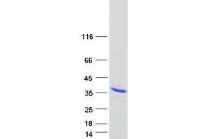 Western Blotting (WB) image for Adenylate Kinase 2 (AK2) protein (Myc-DYKDDDDK Tag) (ABIN2714402)