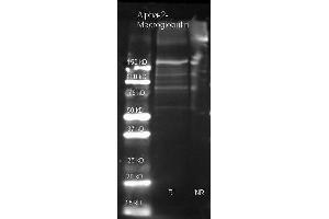 Goat anti Alpha-2-Macroglobulin antibody  was used to detect Alpha-2-Macroglobulin under reducing (R) and non-reducing (NR) conditions. (alpha 2 Macroglobulin 抗体  (HRP))