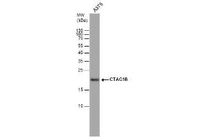WB Image CTAG1B antibody detects CTAG1B protein by western blot analysis. (CTAG1B 抗体)