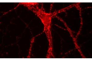 Immunofluorescence labeling of hippocampus neurons, (dilution 1 : 500). (VAMP1, 2, 3 (AA 1-81) 抗体)