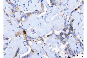 IHC analysis of Desmoglein 2/DSG2 using anti-Desmoglein 2/DSG2 antibody (ABIN7600804).