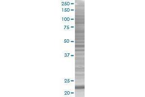 PYCARD transfected lysate. (PYCARD 293T Cell Transient Overexpression Lysate(Denatured))