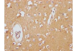 IHC image of ABIN7127430 diluted at 1:100 and staining in paraffin-embedded human brain tissue performed on a Leica BondTM system. (Recombinant Clusterin 抗体)
