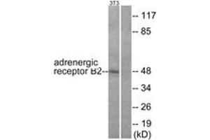 Western blot analysis of extracts from NIH-3T3 cells, using Adrenergic Receptor beta2 (Ab-346) Antibody. (beta 2 Adrenergic Receptor 抗体  (AA 321-370))