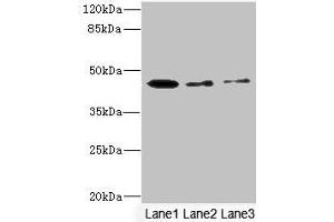 Western blot All lanes: SIGIRR antibody at 1. (SIGIRR 抗体  (AA 1-120))