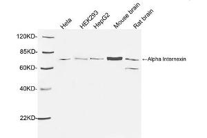 Western blot analysis of tissue and cell lysates using 1 µg/mL Rabbit Anti-Alpha Internexin Polyclonal Antibody (ABIN398867) The signal was developed with IRDyeTM 800 Conjugated Goat Anti-Rabbit IgG. (INA 抗体  (AA 100-150))