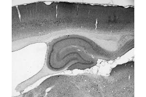 Adult rat hippocampus immunohistochemistry. (SNAPIN 抗体  (AA 115-136))