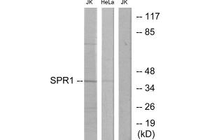 Western blot analysis of extracts from Jurkat cells and HeLa cells, using SPR1 antibody. (SPR1 抗体  (C-Term))