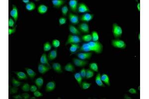 Immunofluorescence staining of Hela cells with ABIN7146412 at 1:100, counter-stained with DAPI. (PDE1A 抗体  (AA 1-219))