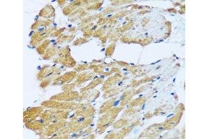 Immunohistochemistry of paraffin-embedded Rat heart using ARHGEF5 Polyclonal Antibody at dilution of 1:100 (40x lens). (ARHGEF5 抗体)