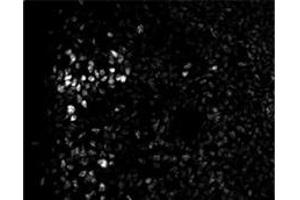 Sample Type: Embryonic Spinal Cord  Dilution: 1:200 (ZEB2 抗体  (N-Term))
