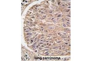 Immunohistochemistry (Paraffin-embedded Sections) (IHC (p)) image for anti-Inhibitor of kappa Light Polypeptide Gene Enhancer in B-Cells, Kinase beta (IKBKB) antibody (ABIN1882097)