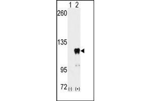Image no. 3 for anti-Pumilio Homolog 2 (Drosophila) (PUM2) (Ser182) antibody (ABIN360017) (PUM2 抗体  (Ser182))