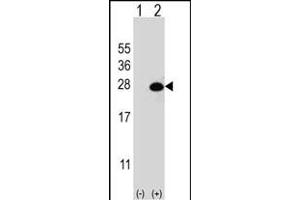 Western blot analysis of DGCR6L (arrow) using rabbit polyclonal DGCR6L Antibody (Center) (ABIN656835 and ABIN2846045). (DGCR6L 抗体  (AA 108-135))