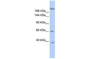 KIF13B antibody used at 1 ug/ml to detect target protein. (KIF13B 抗体  (N-Term))
