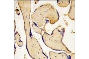 Formalin-fixed and paraffin-embedded human placenta tissue reacted with EphA3 antibody (C-term ), which was peroxidase-conjugated to the secondary antibody, followed by DAB staining. (EPH Receptor A3 抗体  (C-Term))