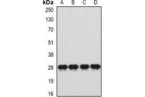 Western blot analysis of HLA-DQA1 expression in SW620 (A), HT29 (B), mouse brain (C), mouse stomach (D) whole cell lysates. (HLA-DQA1 抗体)