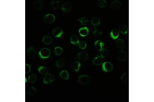 IHC analysis of CIAS1/NALP3 using anti-CIAS1/NALP3 antibody . (NLRP3 抗体  (N-Term))
