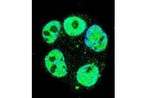 Confocal immunofluorescent analysis of METTL2 Antibody (C-term)(Cat#AP52675PU-N) with ZR-75-1 cell followed by Alexa Fluor 488-conjugated goat anti-rabbit lgG (green). (METTL2 抗体  (C-Term))