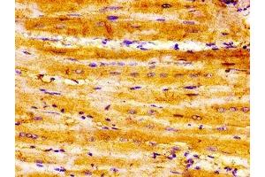 Immunohistochemistry (IHC) image for anti-Sema Domain, Immunoglobulin Domain (Ig), Short Basic Domain, Secreted, (Semaphorin) 3A (SEMA3A) (AA 357-445) antibody (ABIN7168784)