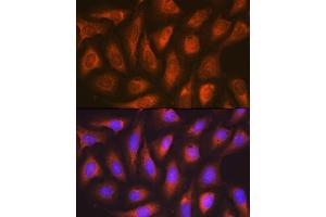 Immunofluorescence analysis of U-2 OS cells using SOCS2 Rabbit mAb (ABIN7270641) at dilution of 1:100 (40x lens). (SOCS2 抗体)