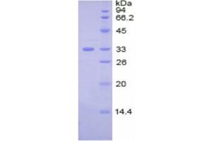 SDS-PAGE (SDS) image for Ceruloplasmin (Ferroxidase) (CP) ELISA Kit (ABIN6574238)