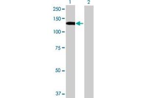 Western Blot analysis of STK31 expression in transfected 293T cell line by STK31 MaxPab polyclonal antibody. (STK31 抗体  (AA 1-1019))