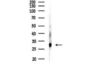 Western blot analysis of lysates from Rat liver, using C Antibody at 1/1000 dilution.