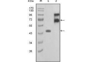 Western blot analysis using FBLN2 mouse mAb against truncated FBLN2-Trx recombinant protein (1) and truncated FBLN2 (aa28-444)-hIgGFc transfected COS7 cell lysate(2). (FBLN2 抗体  (AA 180-440))